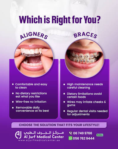 Smile consultation